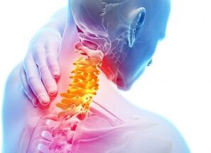 Sakit at silungan sa cervical zone na may ikatlong antas ng osteochondrosis