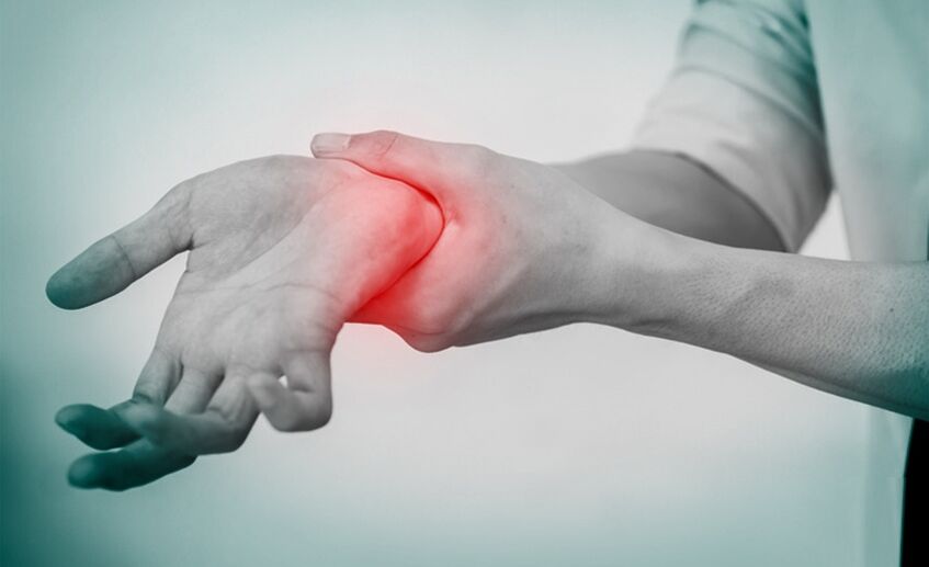Sakit dahil sa arthrosis ng magkasanib na pulso